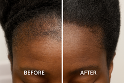 Routine naturelle anti-alopécie : comment prendre soin de vos cheveux au quotidien